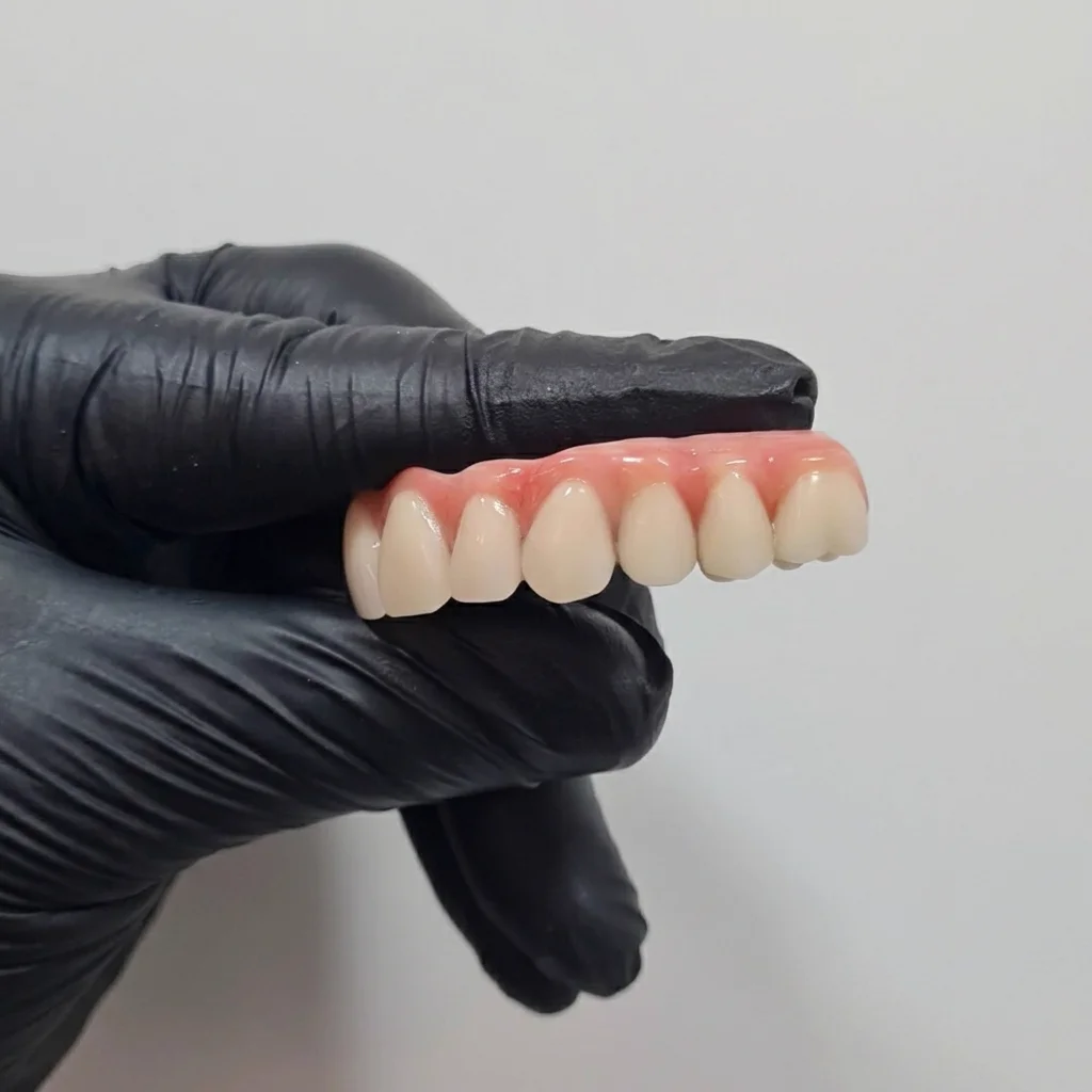 Prótese Protocolo Fixa sobre Implantes - Clínica Isiortho